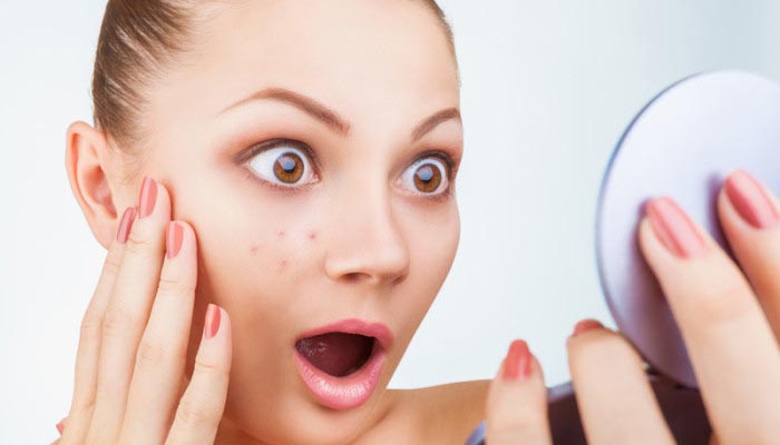 8 Shocking Adult Acne Myths Debunked
