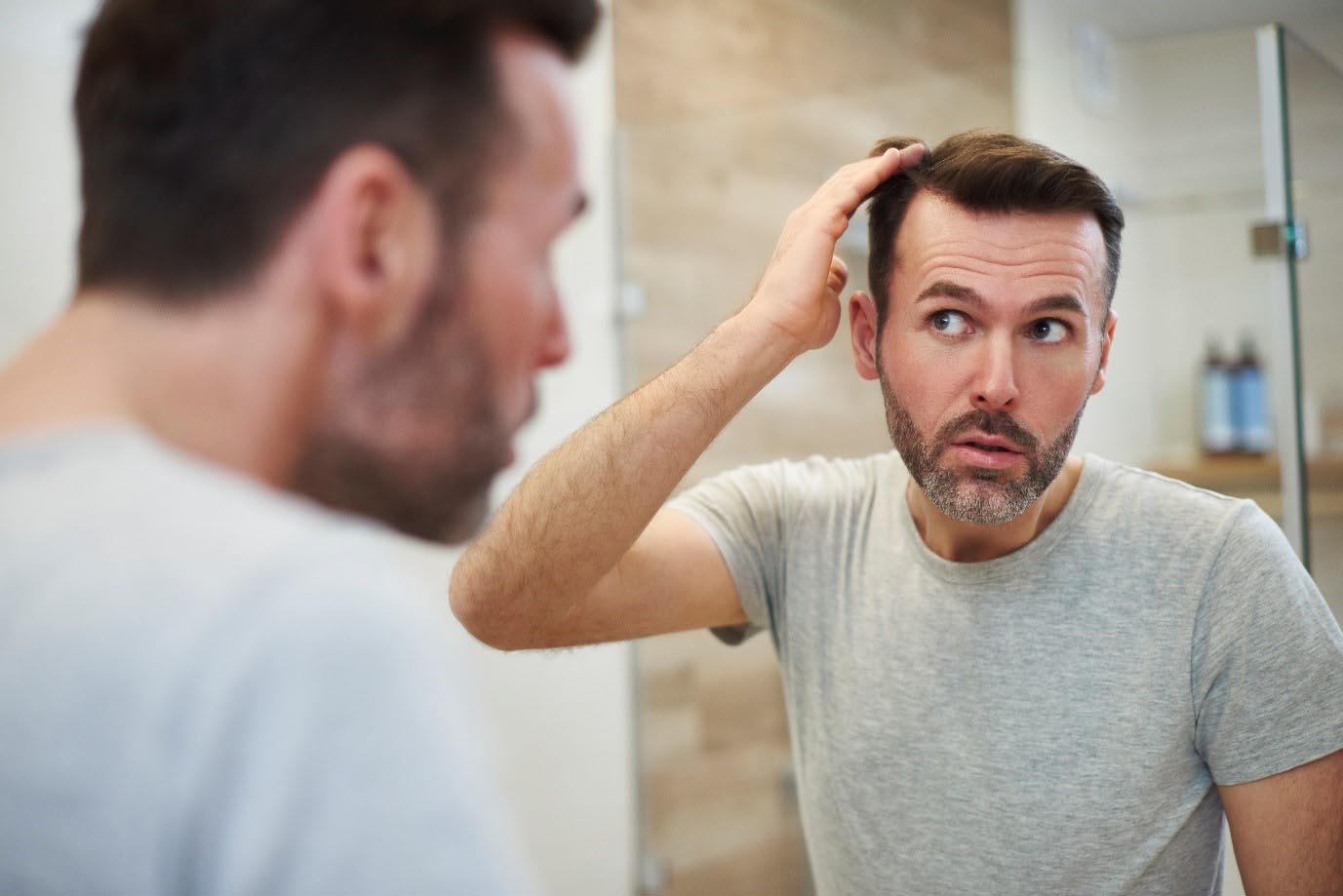 These Hair Loss Treatments are More Affordable and Widely Available Than Ever Before!